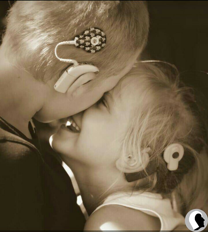 CI Kopf 2018 weiblich Kind